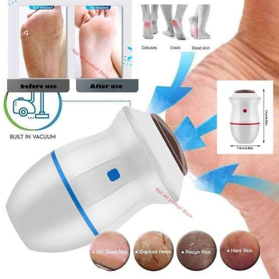 Electric Foot Callus Remover & Pedicure Grinder
