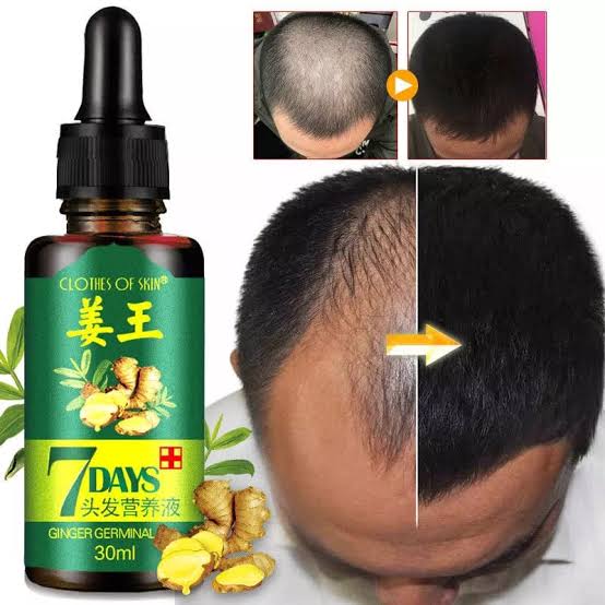 30ml Natural Hair Care Oil Old Gingee Chinese Style Hair Oil Angelica Essential Oil Hair Mask Essential Hair Growth Essence Oil
